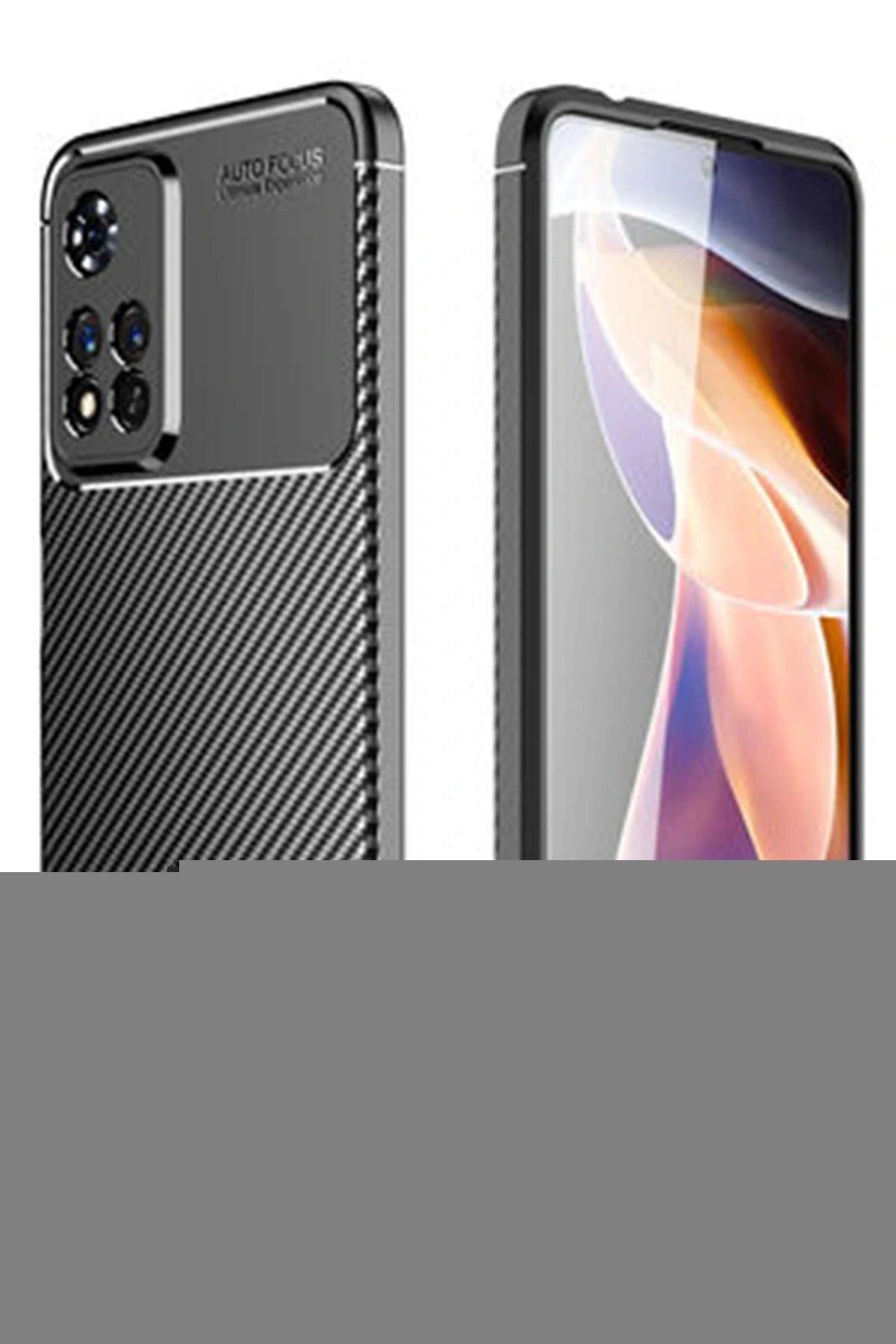 CepteToptan Newface Xiaomi Redmi Note 11 Pro Plus 5G Kılıf Auto Focus Karbon Kapak - Siyah