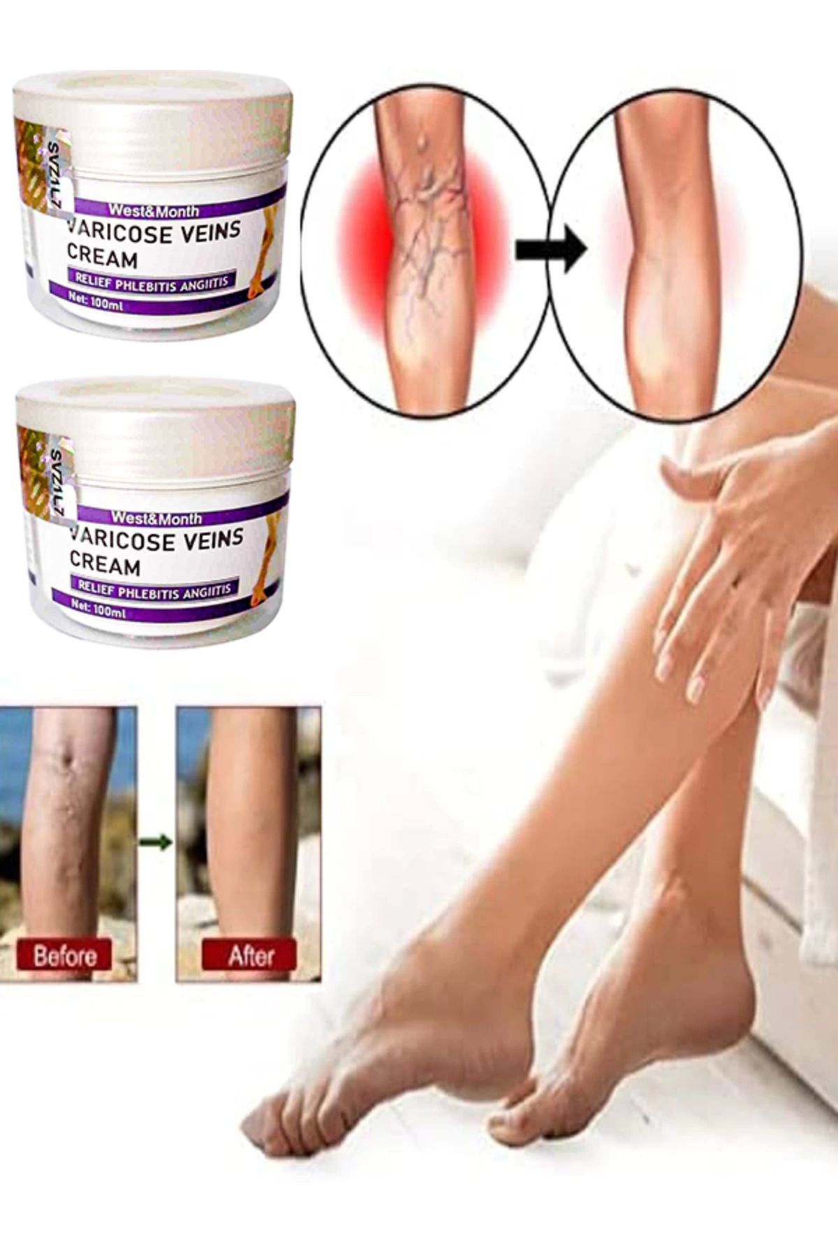 KAKTÜS JACK Varicose and Spider Veins Soothing Leg Cream Bacak Bakım Kremi 100 ml X 2 adet