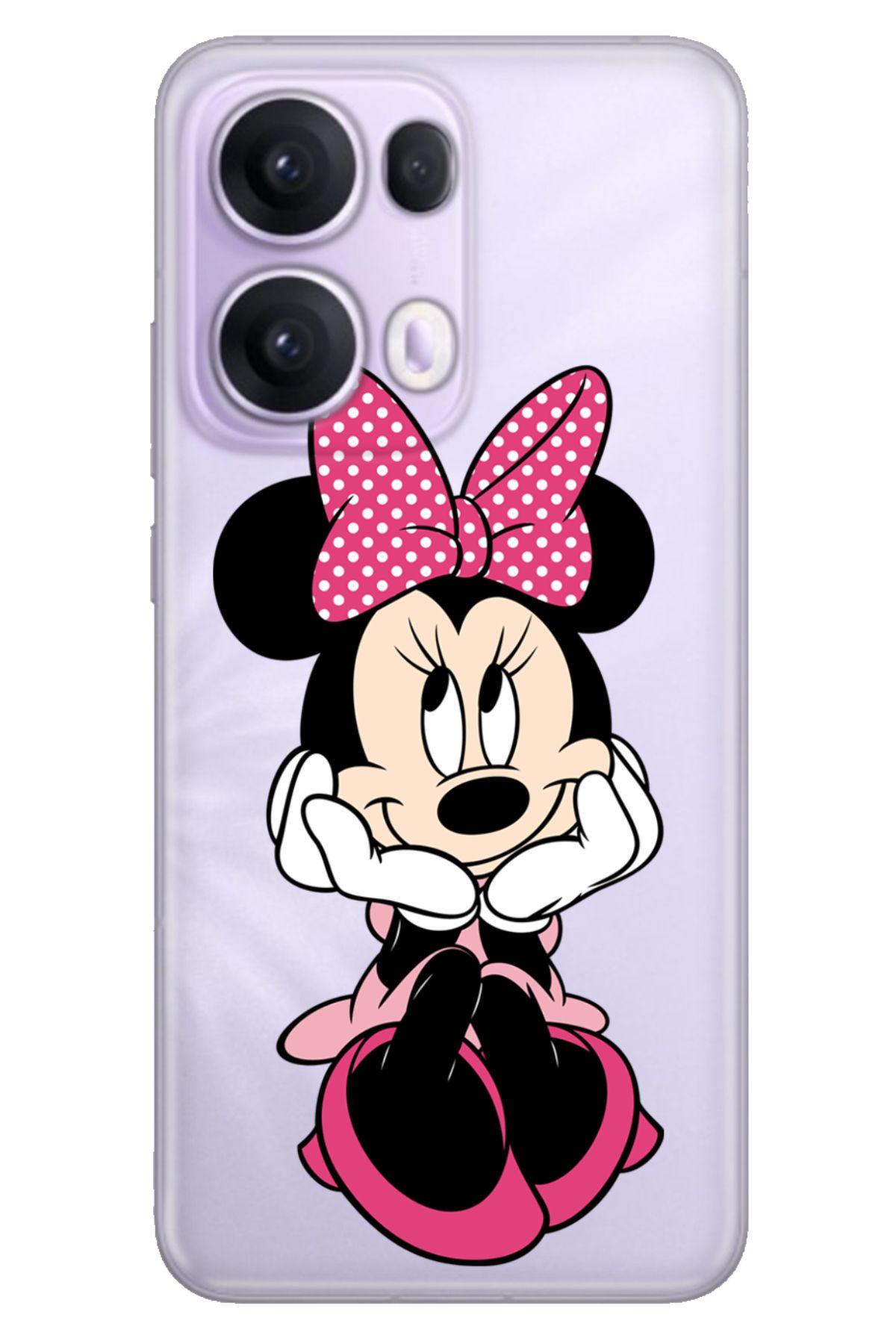 OPPO Reno 13 Pro Kılıf Oppo Renkli Silikon Baskılı TPU Minnie Karakter
