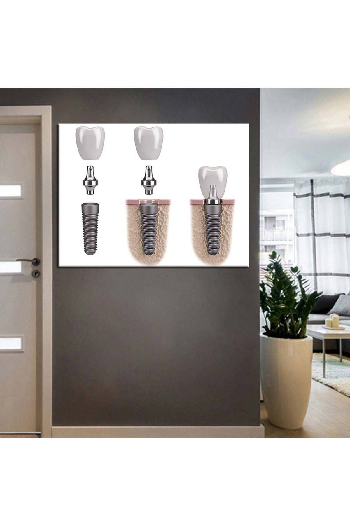 Vividale Ağız Ve Diş Sağlığı Polikliniği tabloları Dekoratif Diş, Dekoratif Dişçi, Dişçi Dekorasyonu