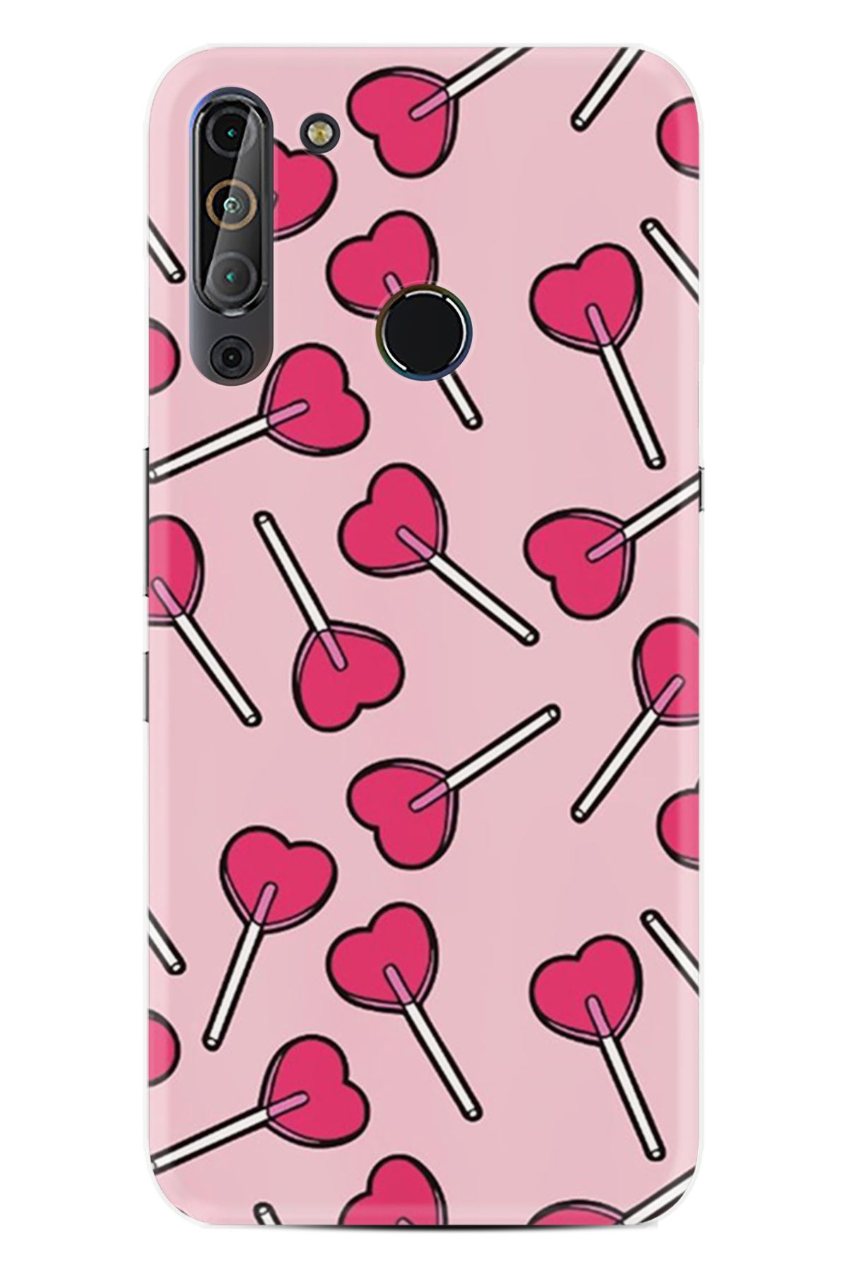 Arvencase Casper VİA X20 HD Baskılı THE BEST OF Seri Desenli Özel Tasarım kılıf XT-X60