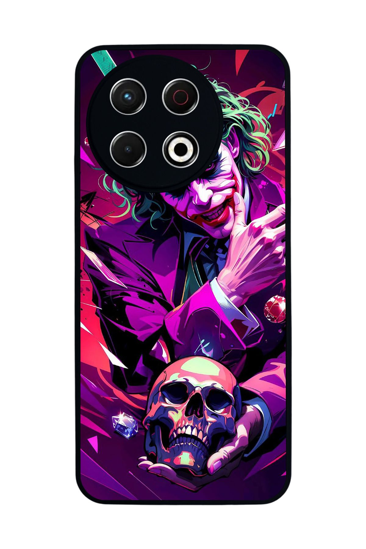 TECNO Spark 30 Pro Mat Siyah Kılıf – Yumuşak Silikon, Koruyucu, Şok Emici Kapak