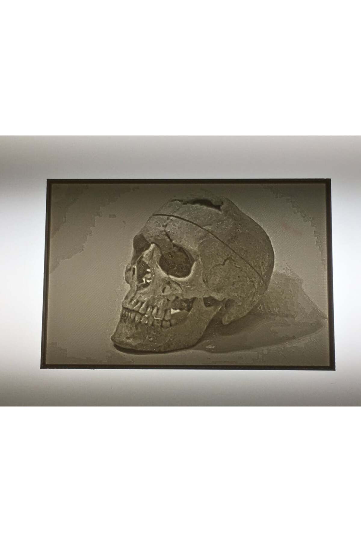 Lucest Phineas Gage Kafatası-Litofan (Plastik Aparattır!!!)