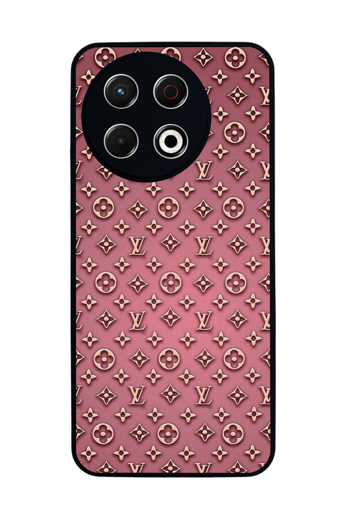TECNO Spark 30 Pro Mat Siyah Kılıf – Yumuşak Silikon, Koruyucu, Şok Emici Kapak