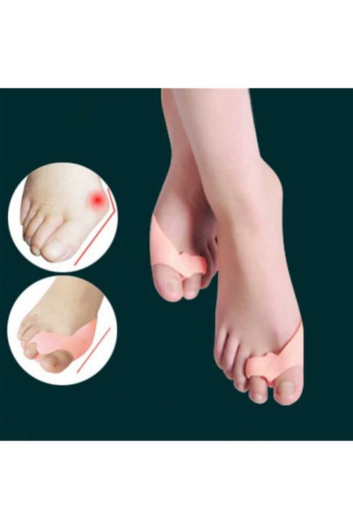 AboutThePerfect Beyaz Makaralı 2 Parmağa Uygun Ayak Bunion Koruyucu Çift