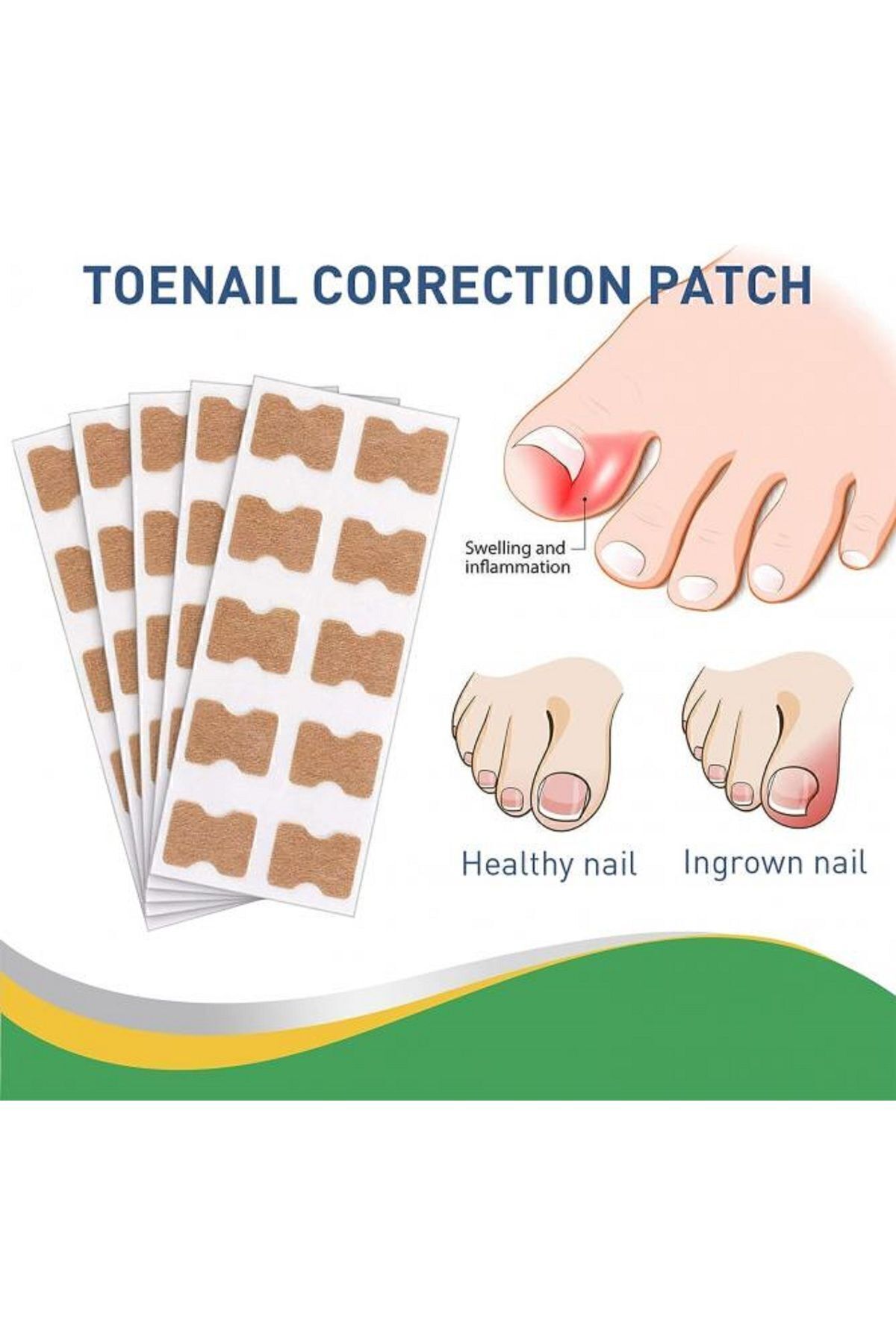 AboutThePerfect 30 Adet Ayak Tırnağı Düzeltici Bandı M-2062, Sağlıklı ve Güzel Görünüm Faktörü