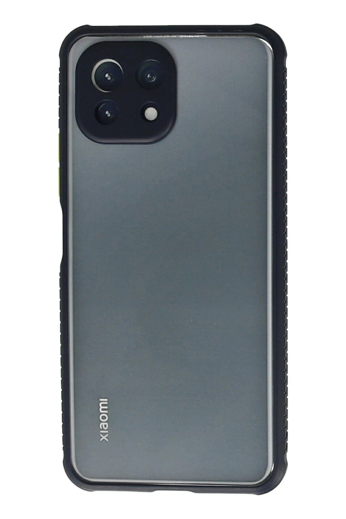 CepteToptan Newface Xiaomi Mİ 11 Lite Kılıf Miami Şeffaf Silikon - Lacivert