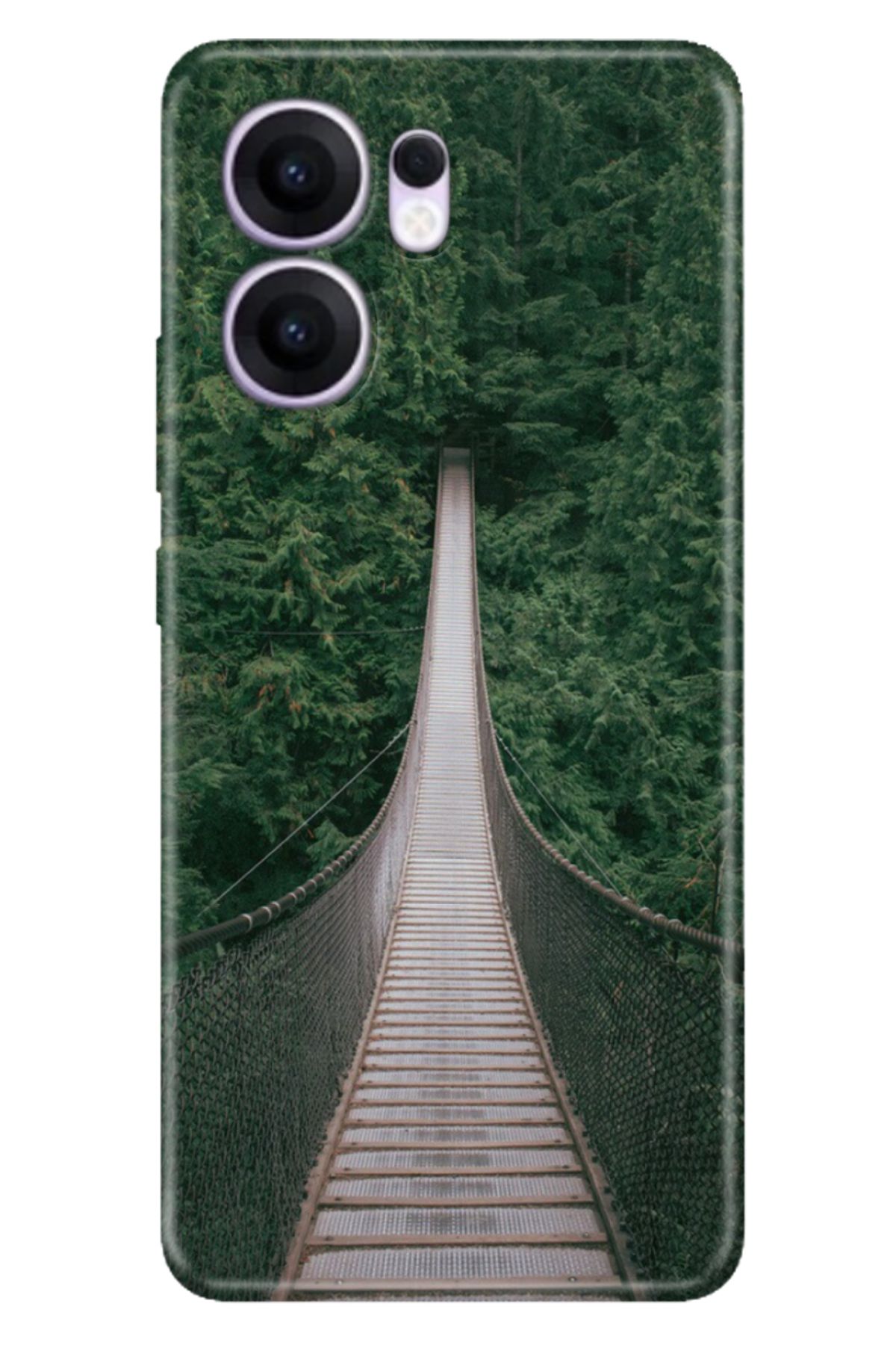 OPPO Reno 13F 5G Kılıf Renkli Silikon Baskılı TPU Korku Köprüsü