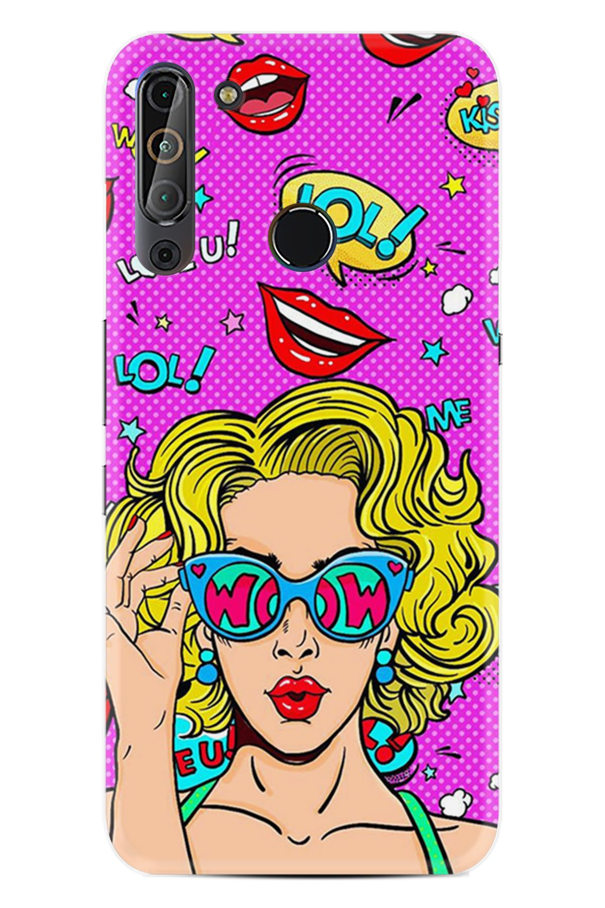 Arvencase Casper VİA X20 HD Baskılı THE BEST OF Seri Desenli Özel Tasarım kılıf XT-X27