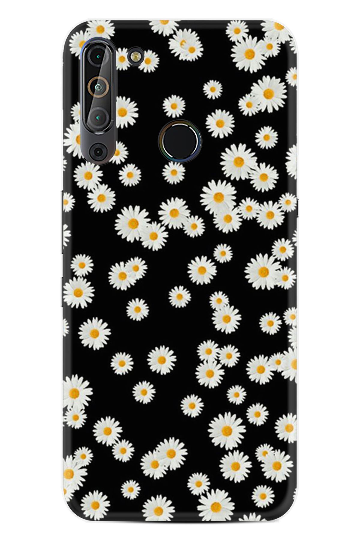 Arvencase Casper VİA X20 HD Baskılı THE BEST OF Seri Desenli Özel Tasarım kılıf XT-X61