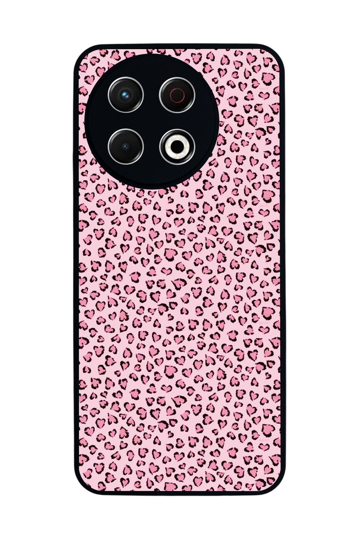 TECNO Spark 30 Pro Mat Siyah Kılıf – Yumuşak Silikon, Koruyucu, Şok Emici Kapak
