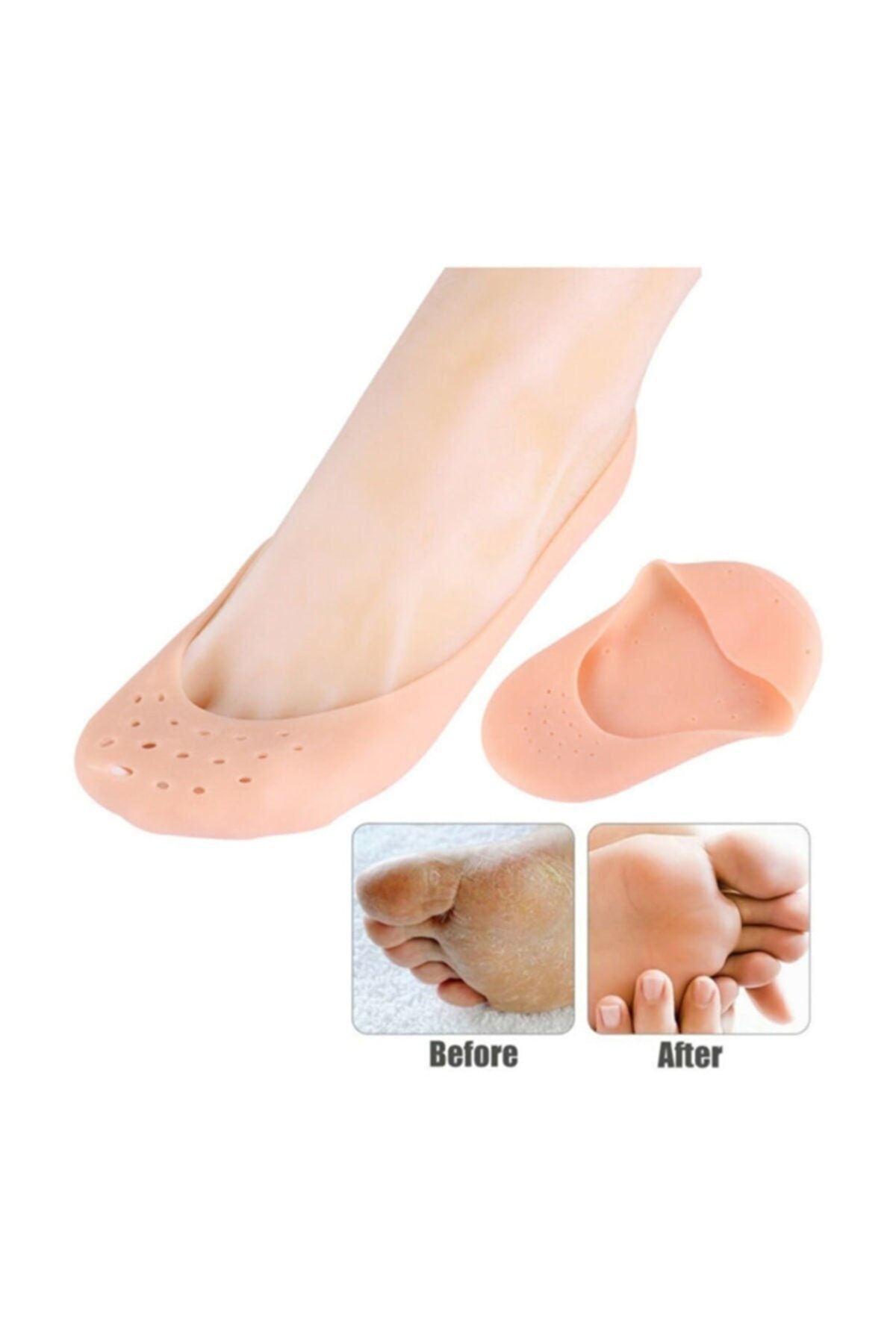AboutThePerfect Yumuşak Silikon Rahatlatıcı Patik Çorap, Topuk Bakım ve Rahatlatıcı Alet, Çift