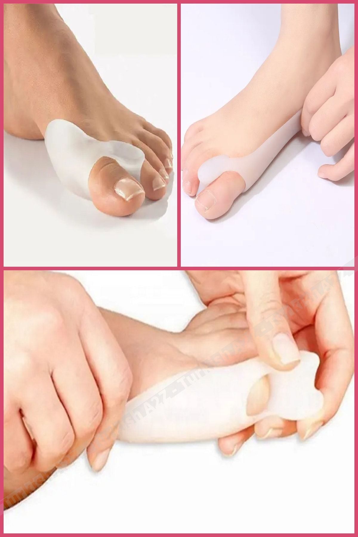 AboutThePerfect Yumuşak silikon makara ile ayak baş parmak destek ve koruma seti