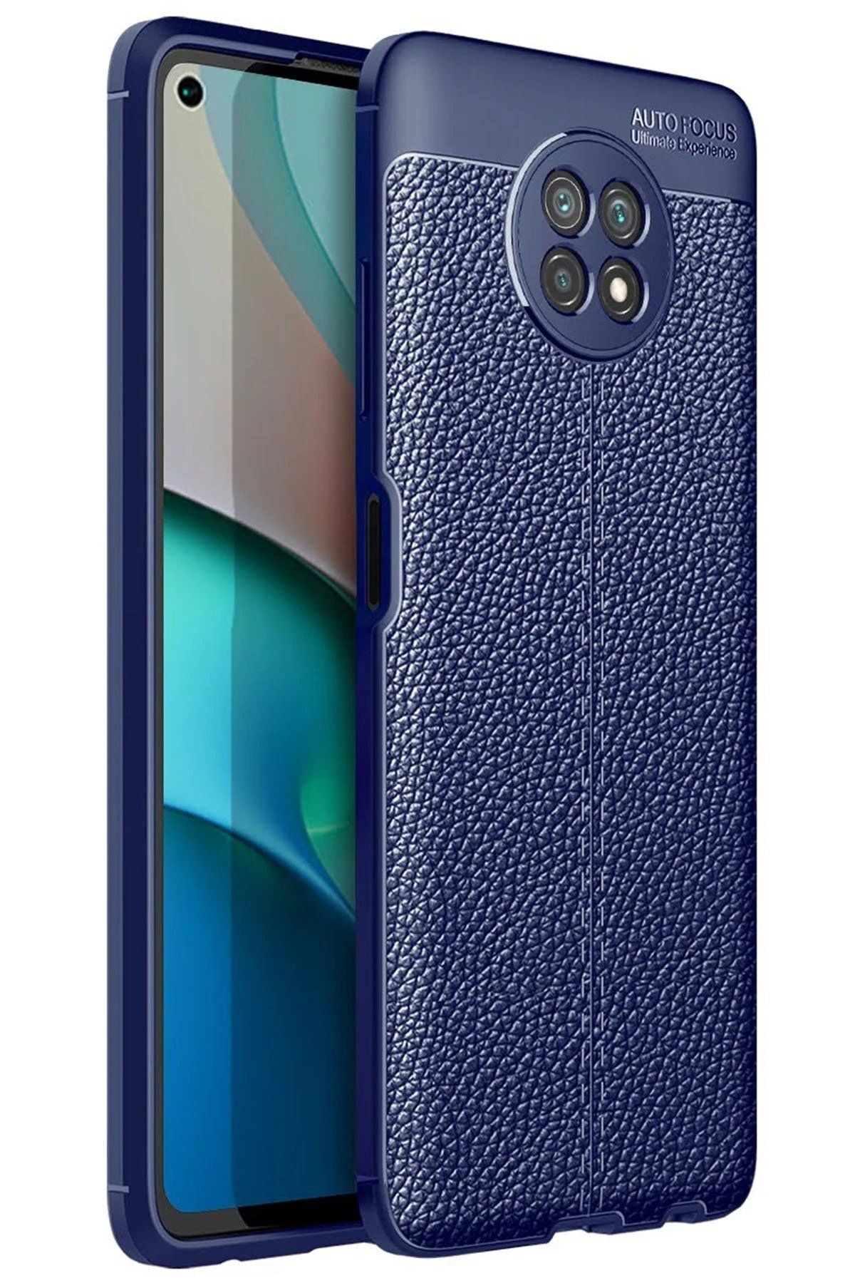 CepteToptan Newface Xiaomi Redmi Note 9 5G Kılıf Auto Focus Kapak - Lacivert
