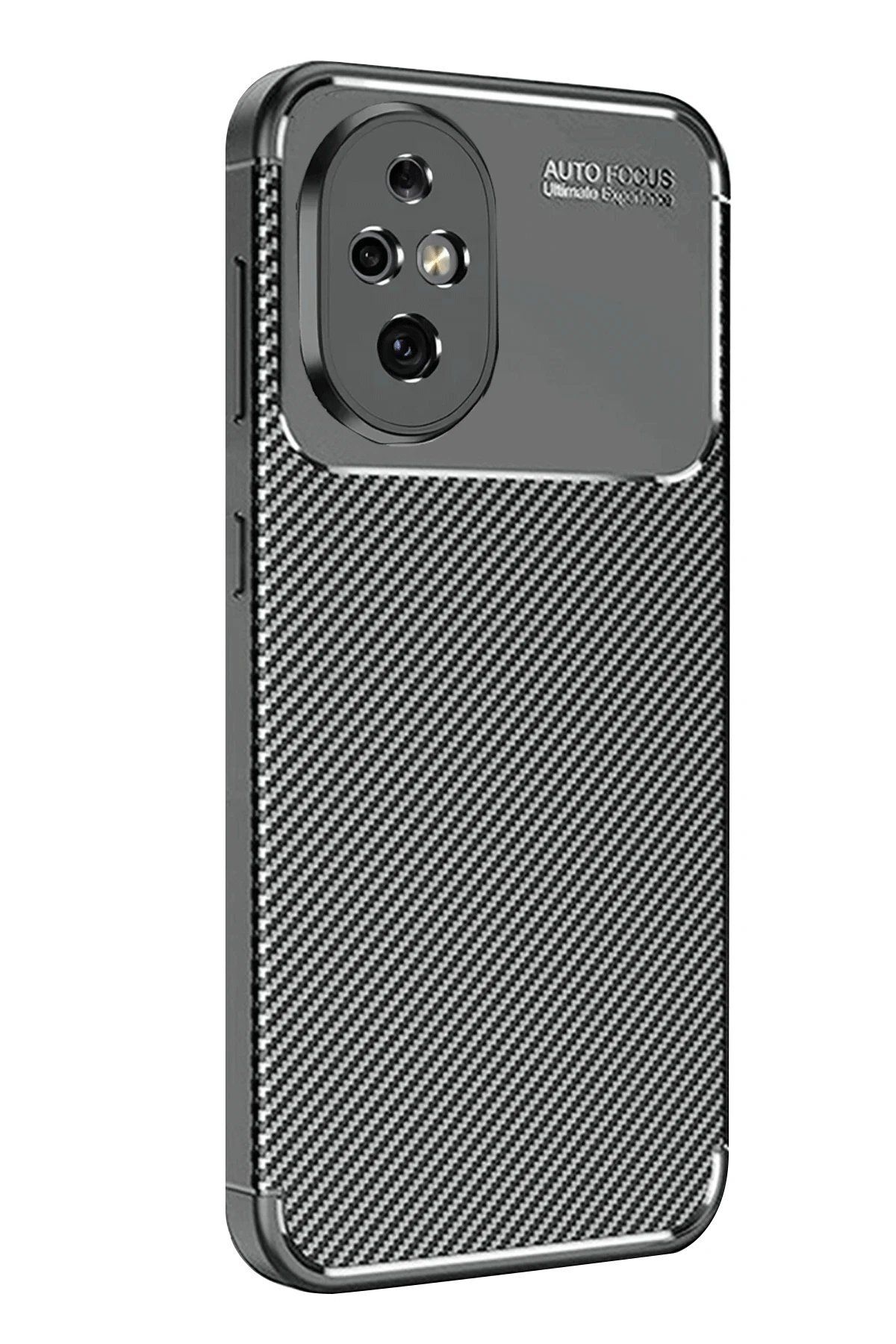 CepteToptan Newface Honor 200 Kılıf Auto Focus Karbon Kapak - Siyah