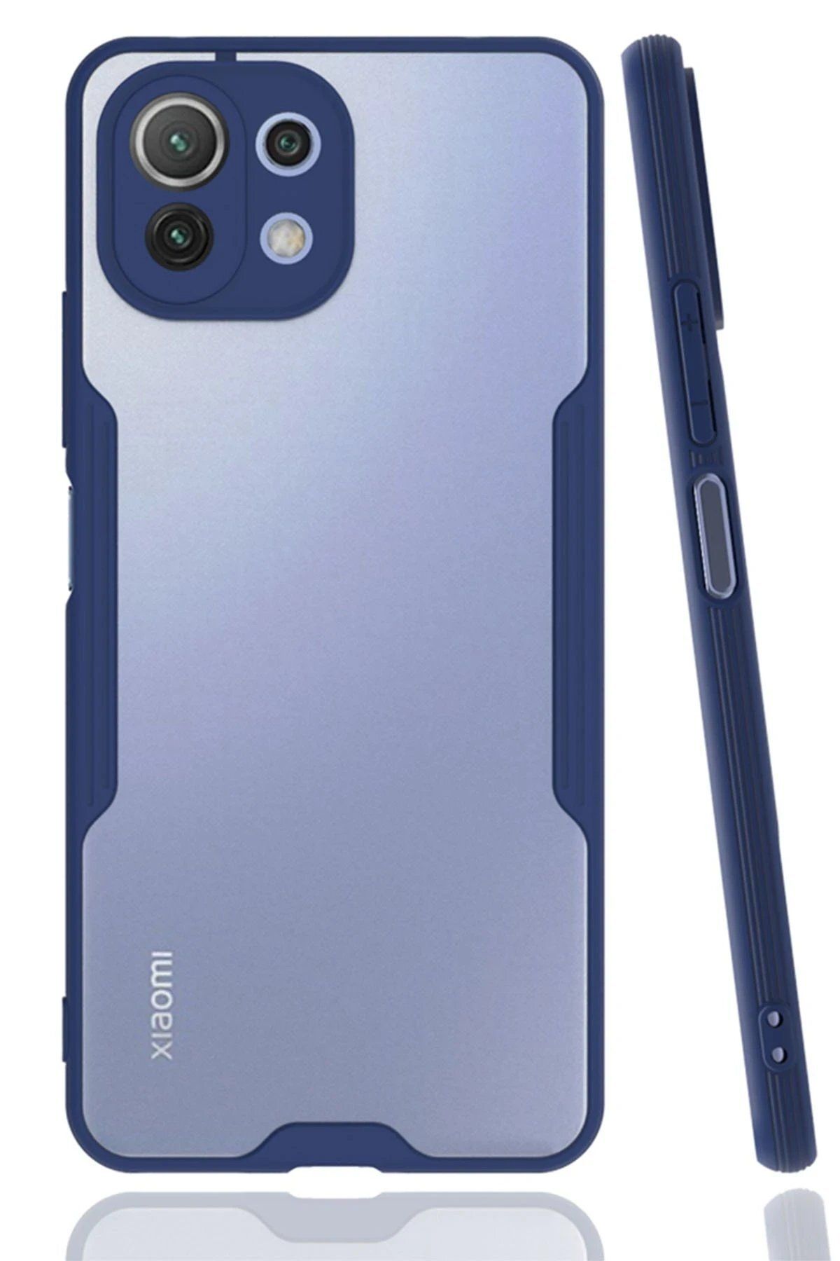 CepteToptan Newface Xiaomi Mİ 11 Lite Kılıf Platin Silikon - Lacivert