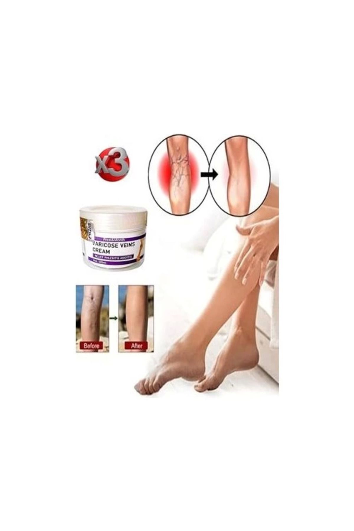 E&E Home Varicose And Spider Veins Soothing Leg Cream Bacak Bakım Kremi 100 ml x 3 Adet
