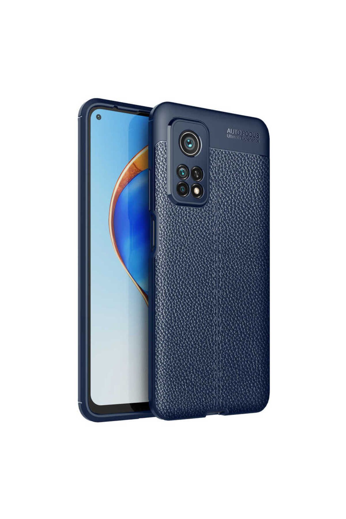 batuteknoloji Xiaomi Mi 10T Kılıf Zore Niss Silikon Kapak