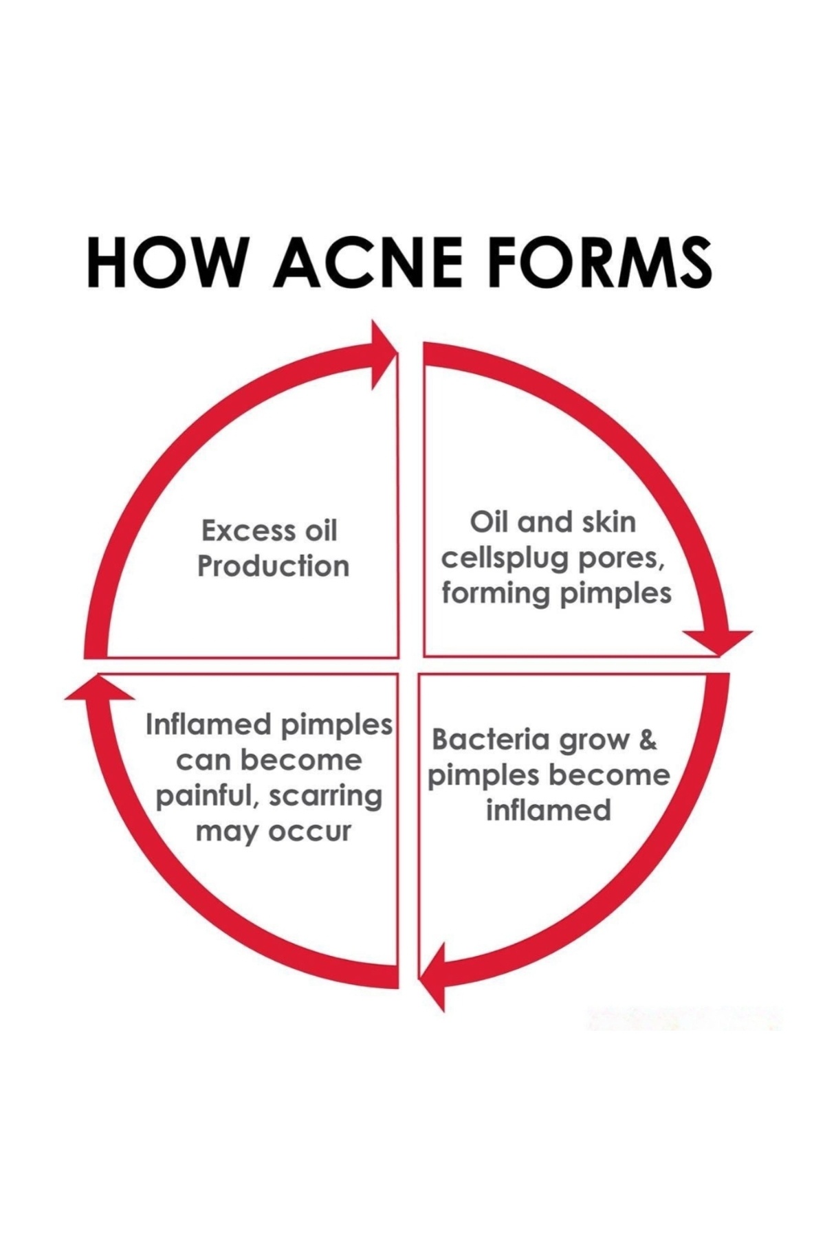 ACM-Sebionex Purifying Bar 100g –soap-free Daily Cleanser For Oily & Acne-prone Skin, Gentle & Effective 3