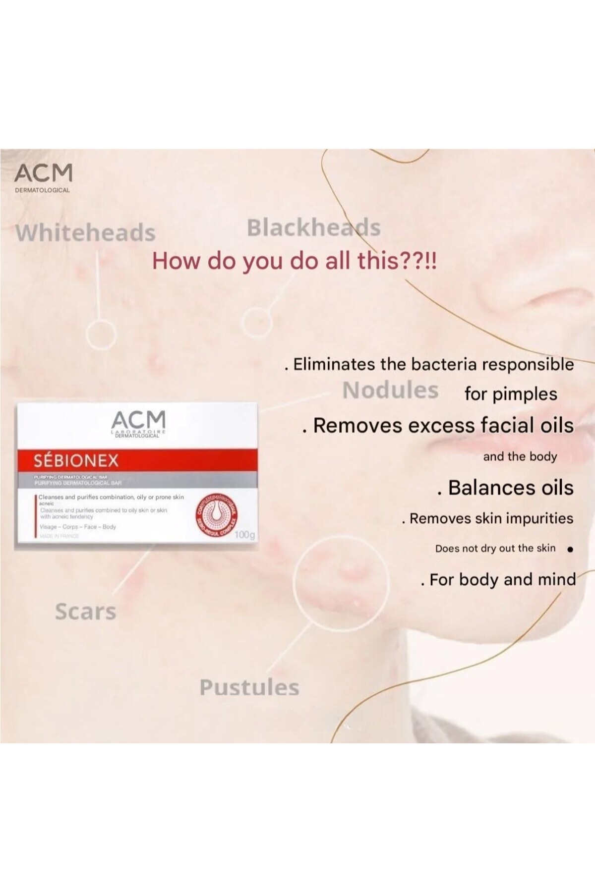 ACM-Sebionex Purifying Bar 100g –soap-free Daily Cleanser For Oily & Acne-prone Skin, Gentle & Effective 2