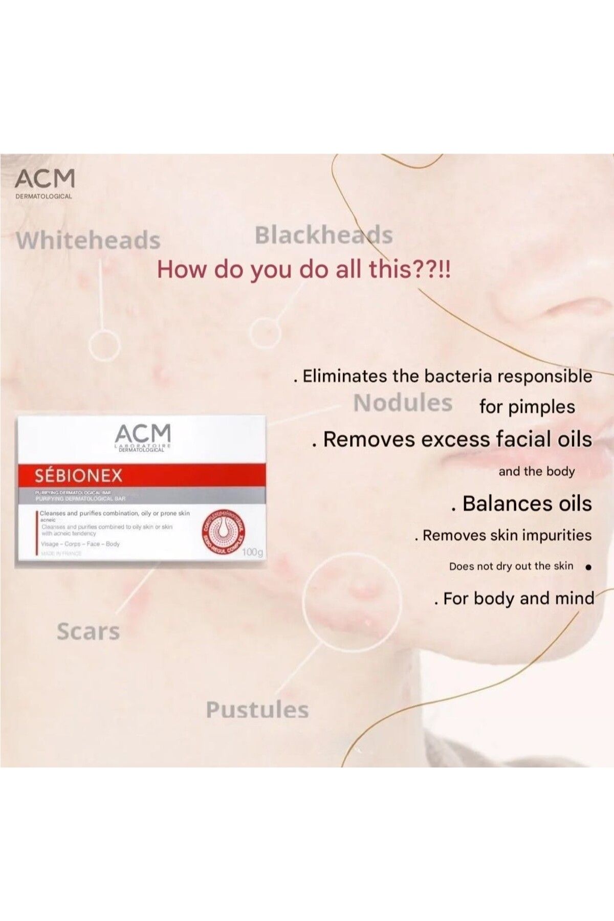 ACM-Laboratoire dermatologique SEBIONEX Purifying dermatological bar 100g 5
