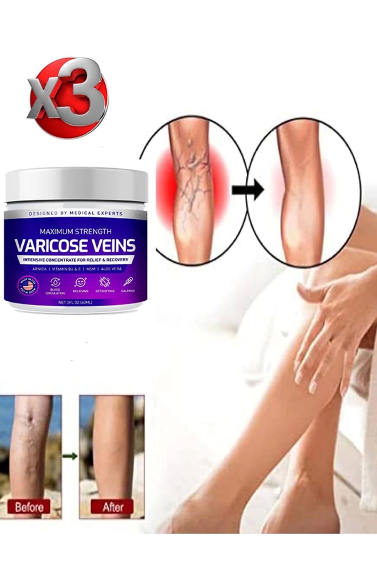 Emper Maximum Strength Varicose Veins Bakım Kremi 100 ml x 3 adet