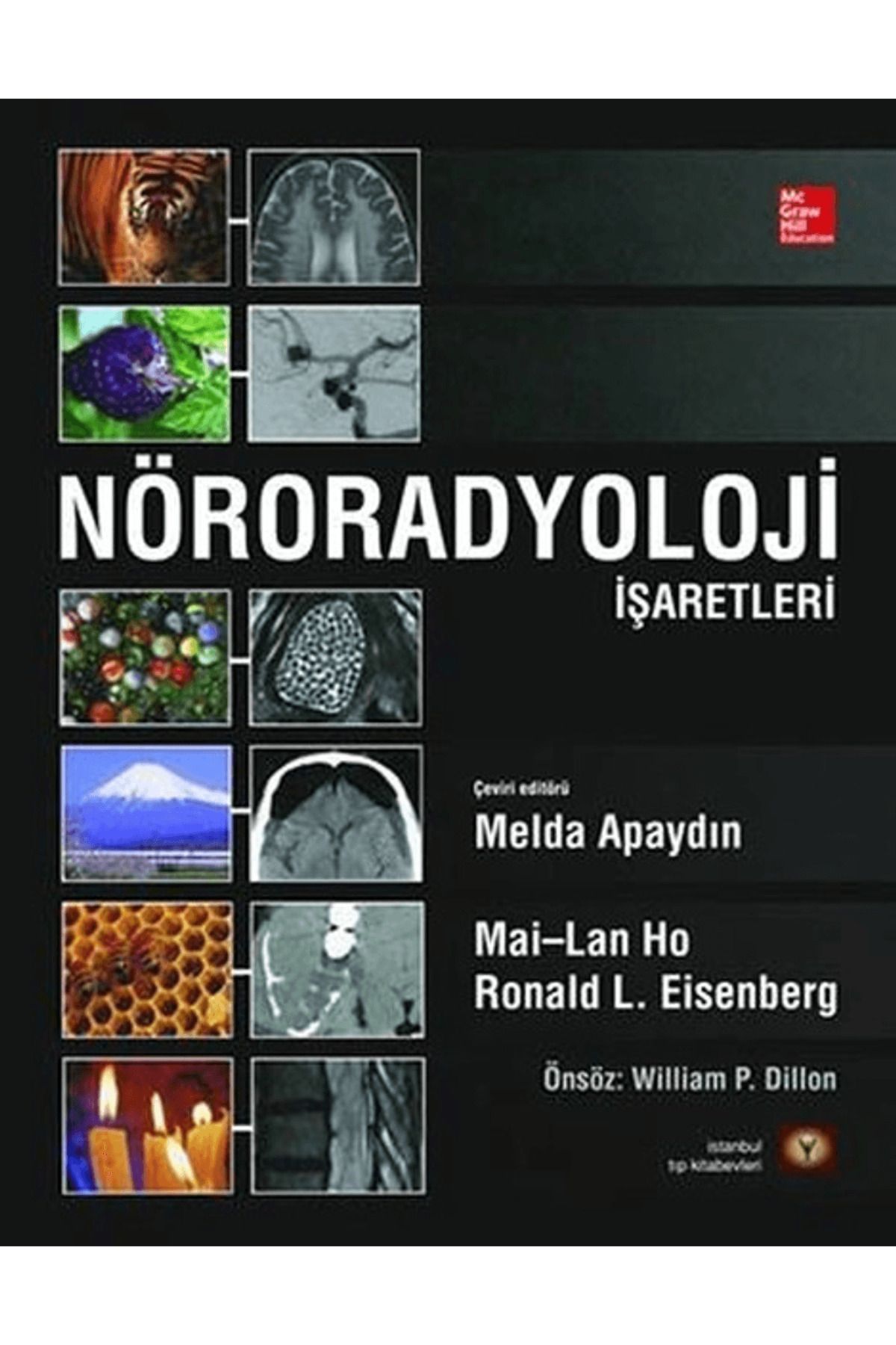İstanbul Tıp Kitabevi Nöroradyoloji İşaretleri