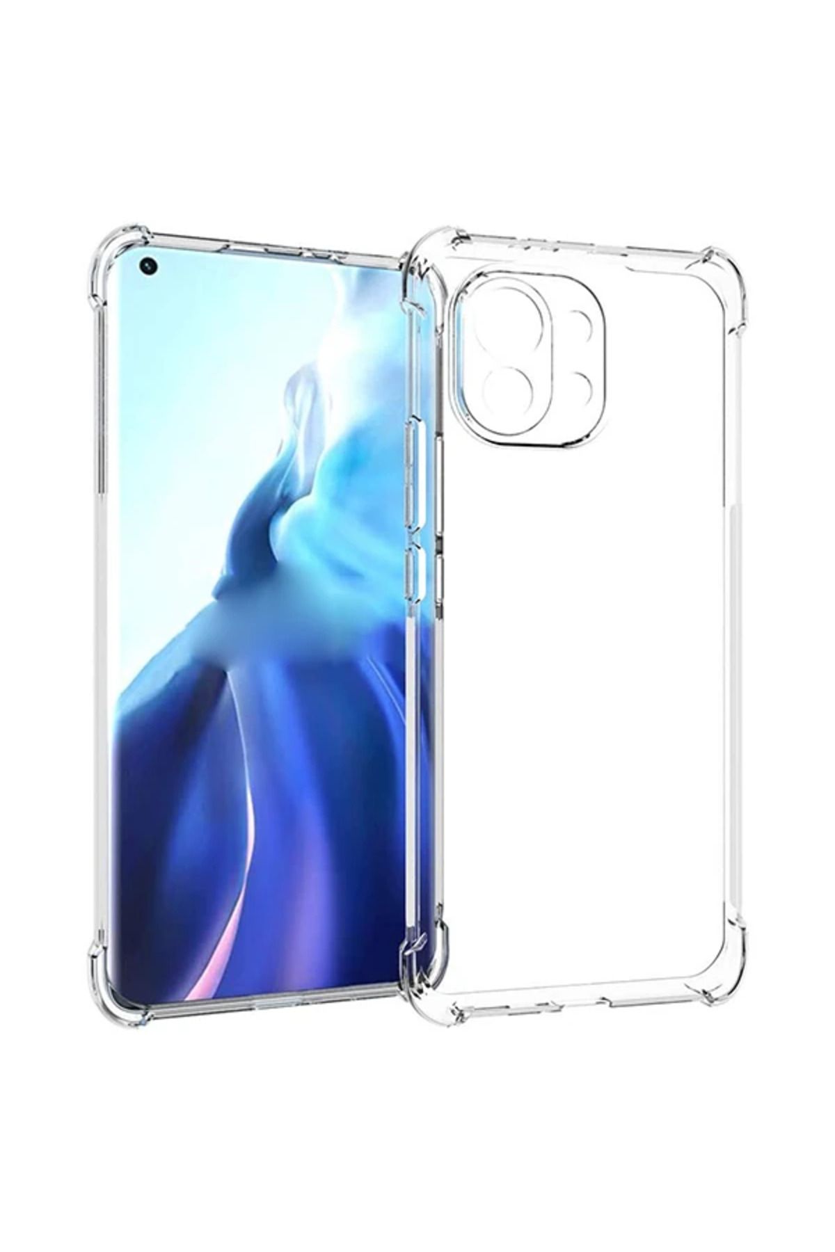 Marsilyan Xiaomi Mi 11 Kamera Korumalı Shockproof Darbe Emici Silikon Kılıf-(5775) - MCT1499-9622