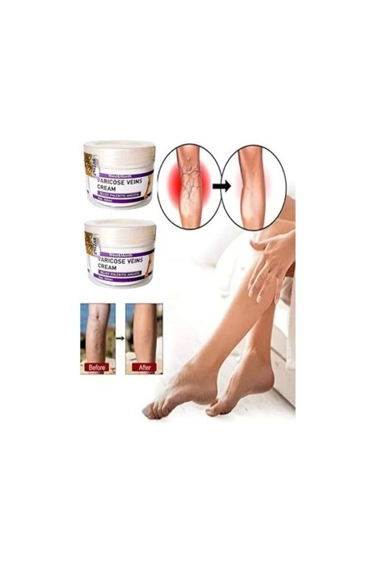 hayalimsah Varicose And Spider Veins Soothing Leg Cream Bacak Bakım Kremi 100 ml x 2 Adet