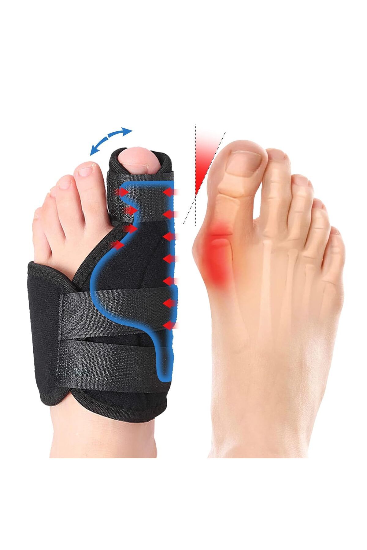 Elite Life 2'li Halluks Valgus Gece Ateli Ayak Baş Parmak Bunyon Koruyucu Splint Sağ SolTabanlık