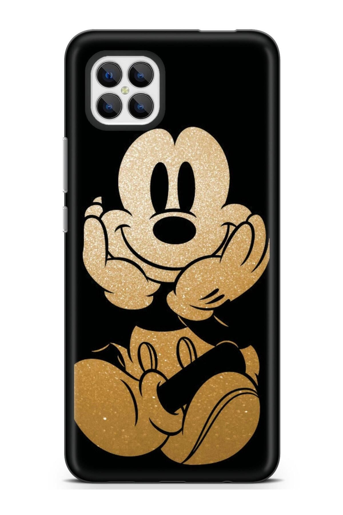 omix X600 Kılıf Kamera Korumalı Baskılı Silikon Kapak - Minymouse7