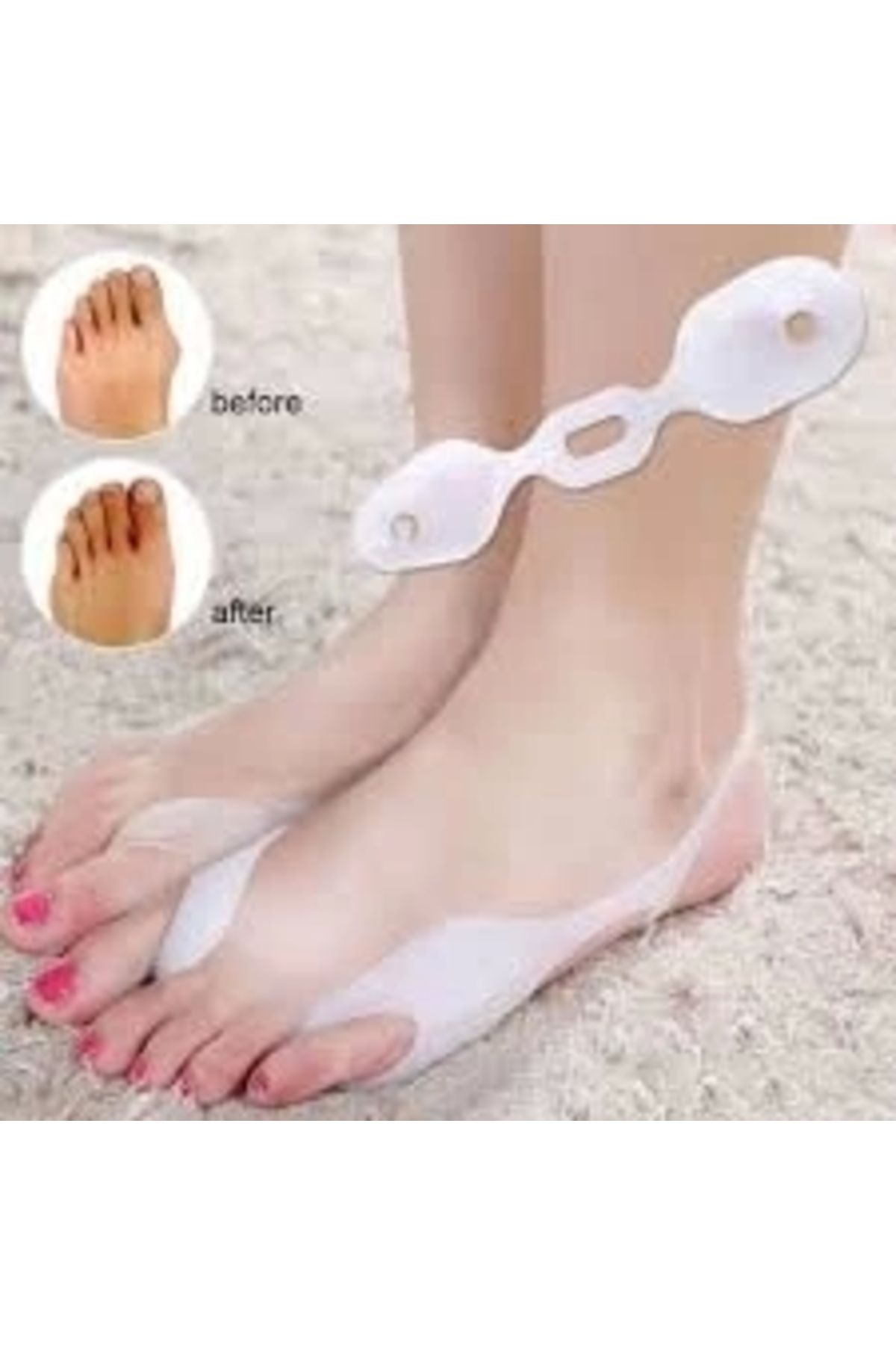 FİXFLEX Restful Atelli Bunyon Koruyucu