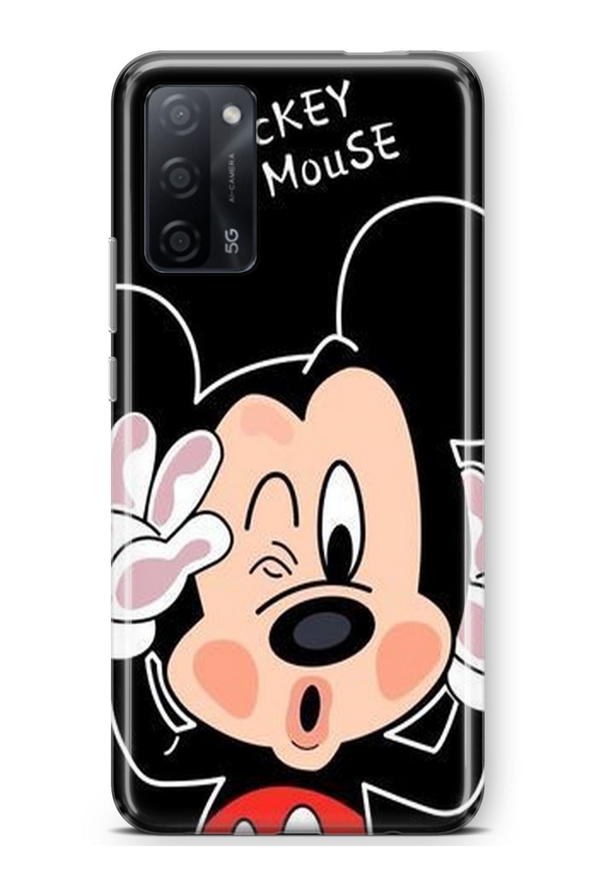 Activist Oppo A55 Kılıfı Standlı Baskılı Parlak Silikon Kapak - Minymouse3