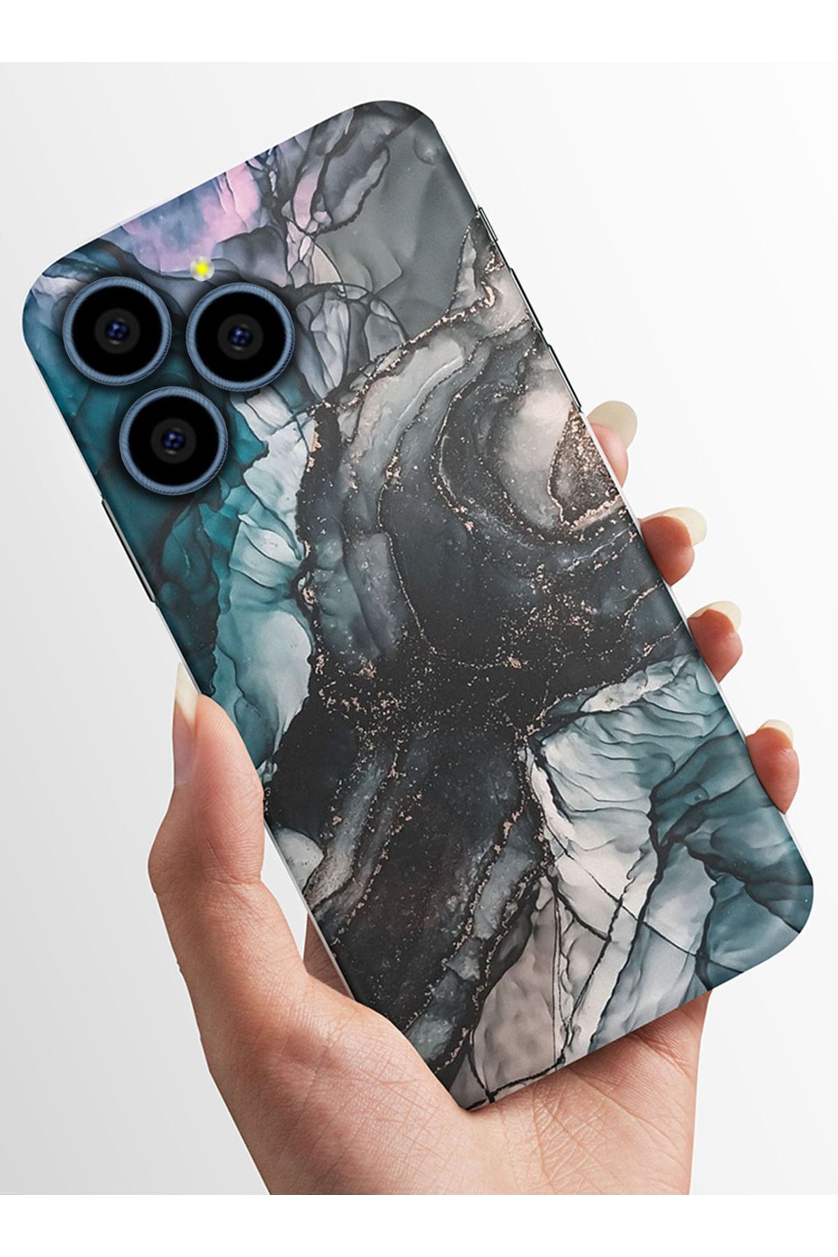 omix X7 Kılıfı HD Kalite Baskılı Parlak Silikon Kapak - mage
