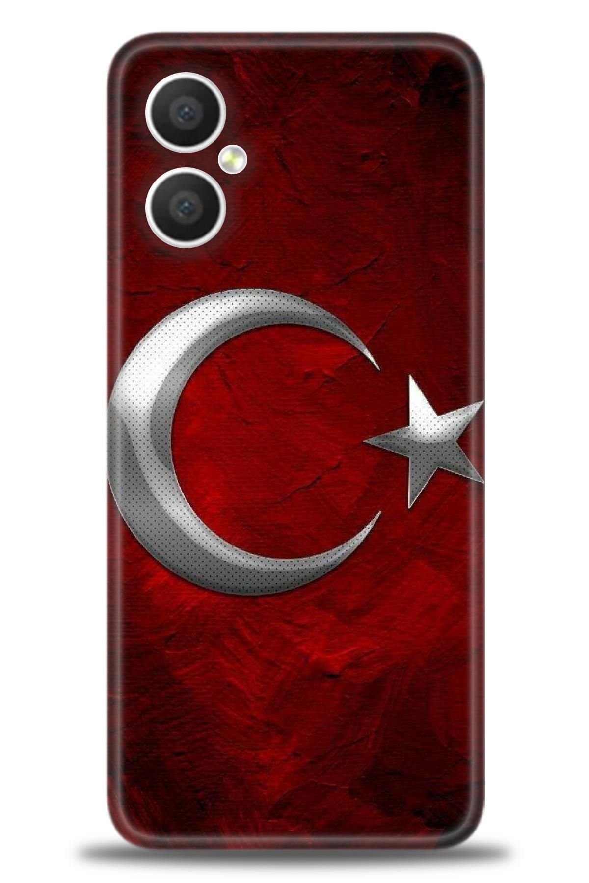 omix X3 / X5 İle Uyumlu HD Baskılı Kılıf - Karışık Seri - 1070