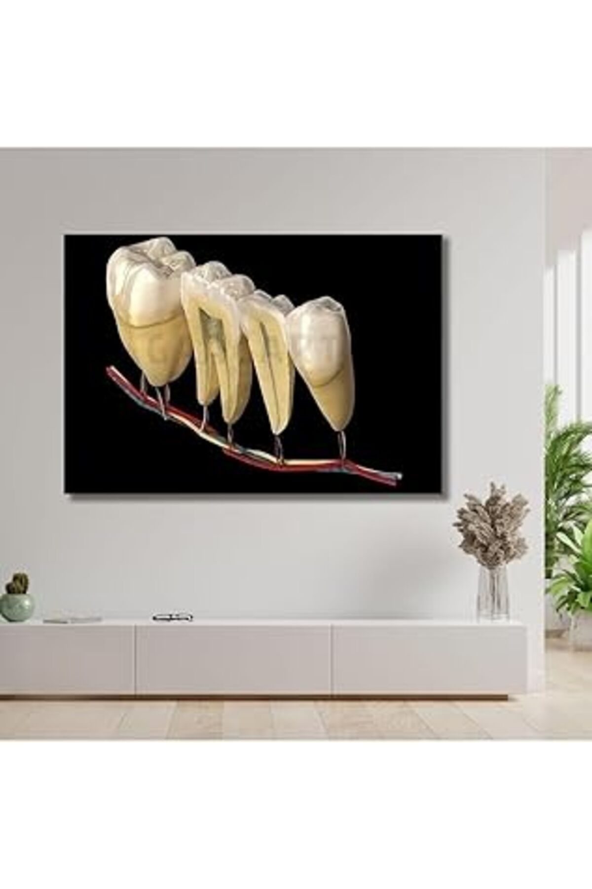 Pazarcan Gaagart Tekli Yatay Kanvas Ağız Ve Diş Poliklinik Dişçi Tablosu Dişler, 40 X 30