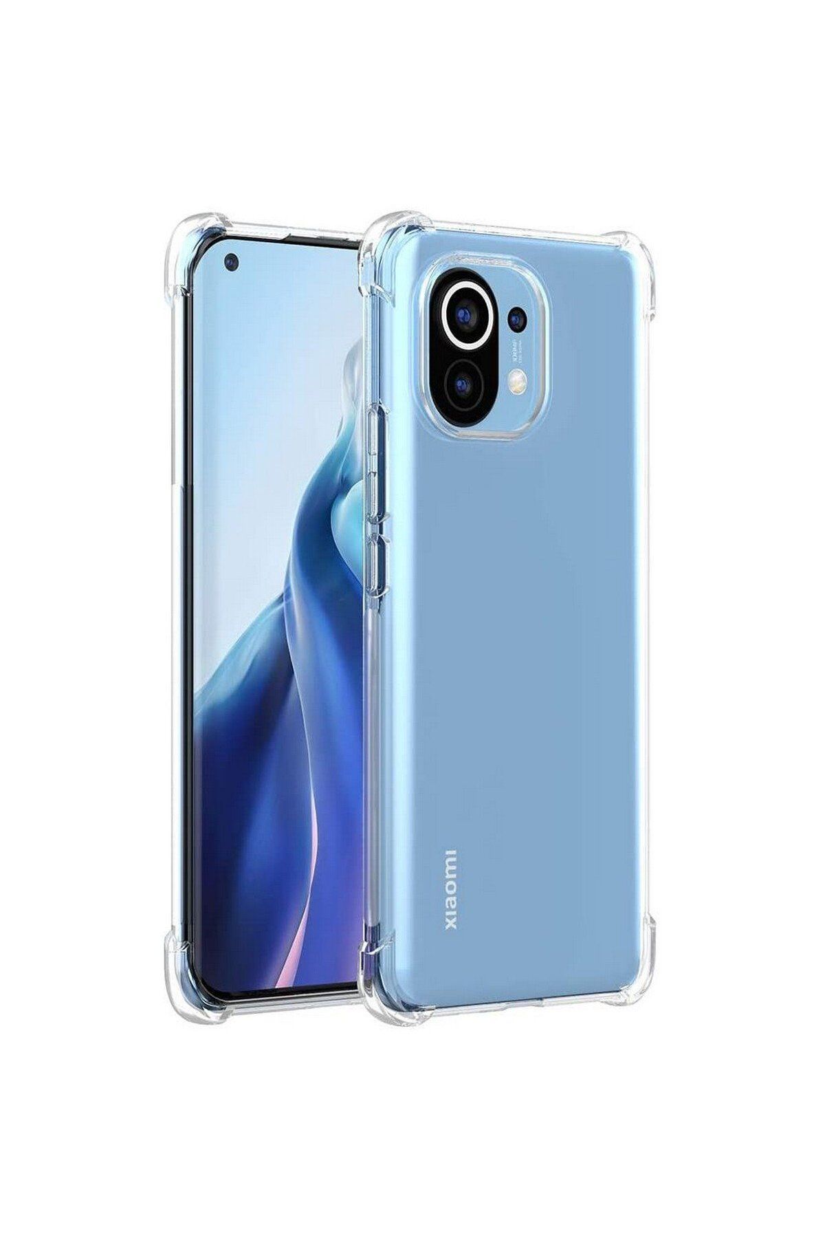 Ehr. Xiaomi Mi 11 Uyumlu Darbe Önleyici Sararmaya Dayanıklı Airbag Korumalı Ultra Slim TPU Şeffaf Silikon