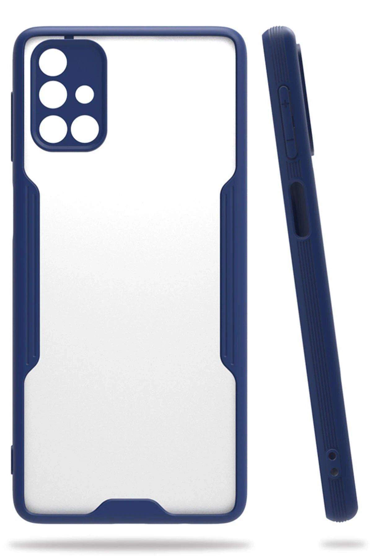 Tilmiz Samsung Galaxy M31S Kılıf Platin Silikon - Lacivert