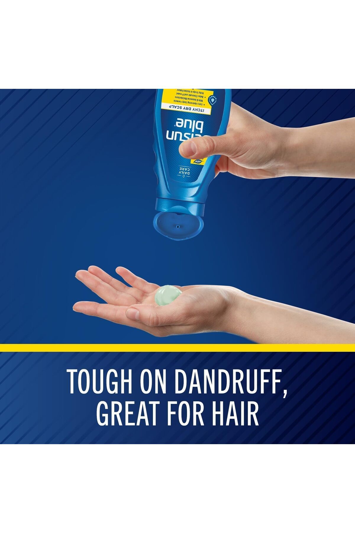 Selsun Blue-Itchy Dry Scalp Anti-dandruff Shampoo, 11 fl. oz, Extra-Hydrating Formula, Pyrithione Zi 7