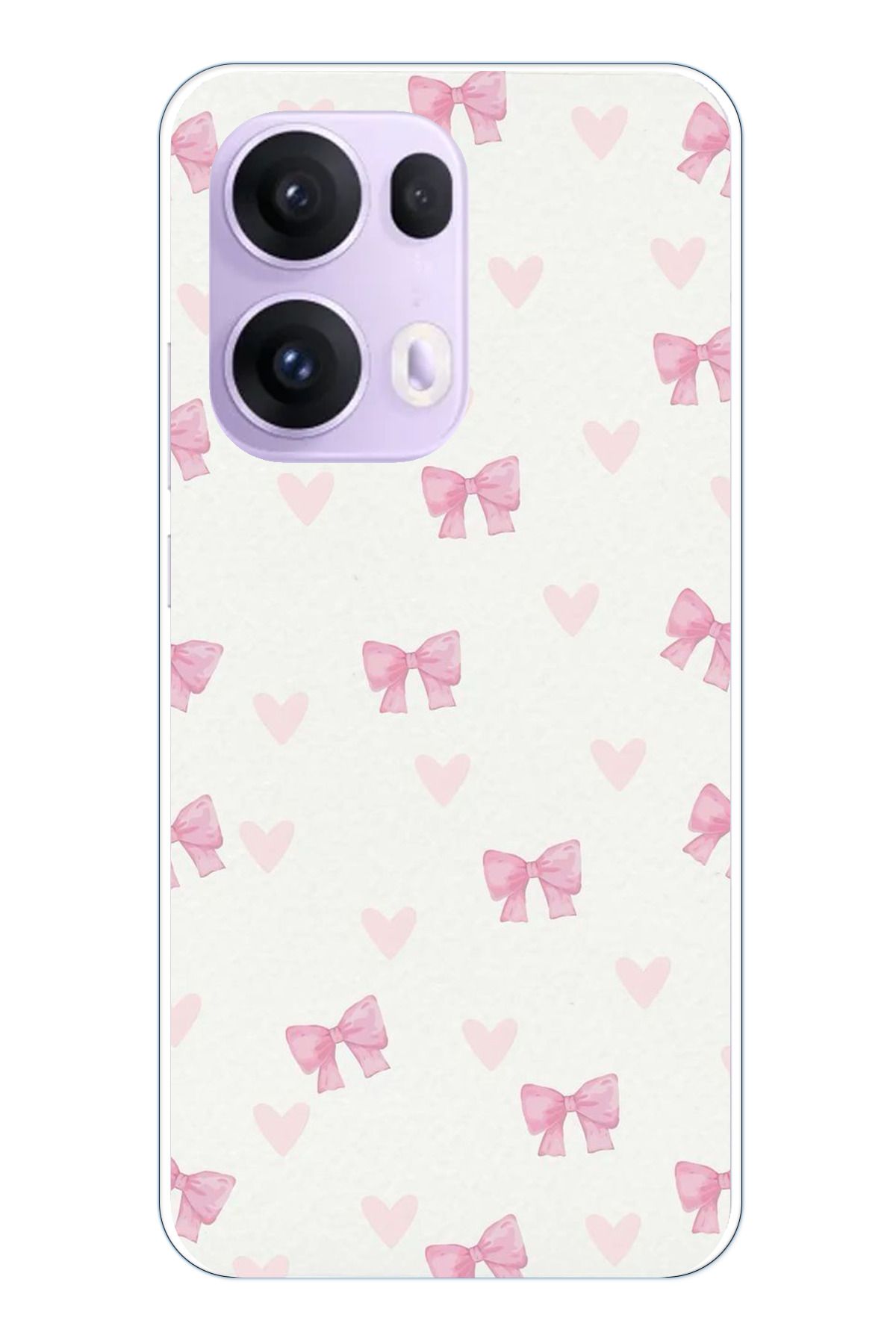 TechTree OPPO Reno 13 PRO Uyumlu Fiyonklar ve Pembe Kalpler Şeffaf Silikon Kılıf