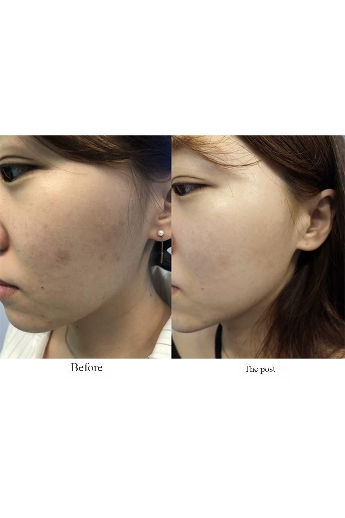 AXIS-Y-Dark Spot Correcting Serum 50ml 4