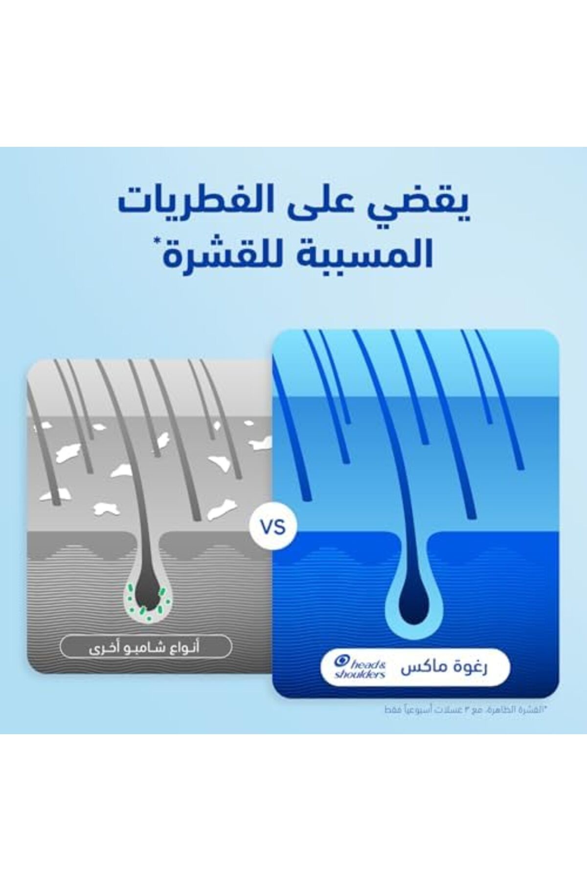 Head&Shoulders-Head & Shoulders Anti-Dandruff Shampoo Lemon Fresh 600ml 8