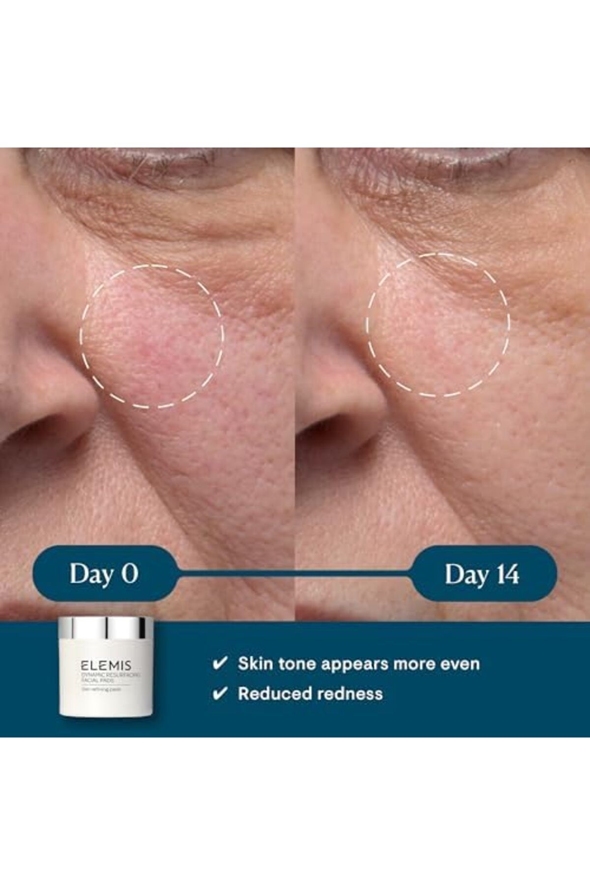 Elemis-Dynamic Resurfacing Facial Pads 4