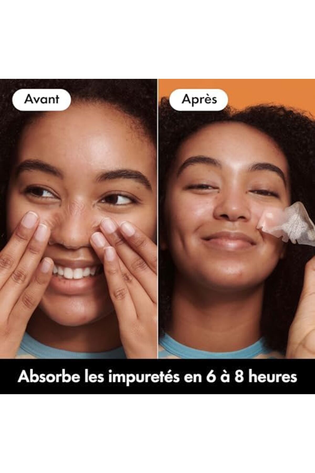 hero cosmetics-Hero - Mighty Patch Nose - Special Nose - Absorbs impurities from pores and pimples in 6 to 8 hours 8