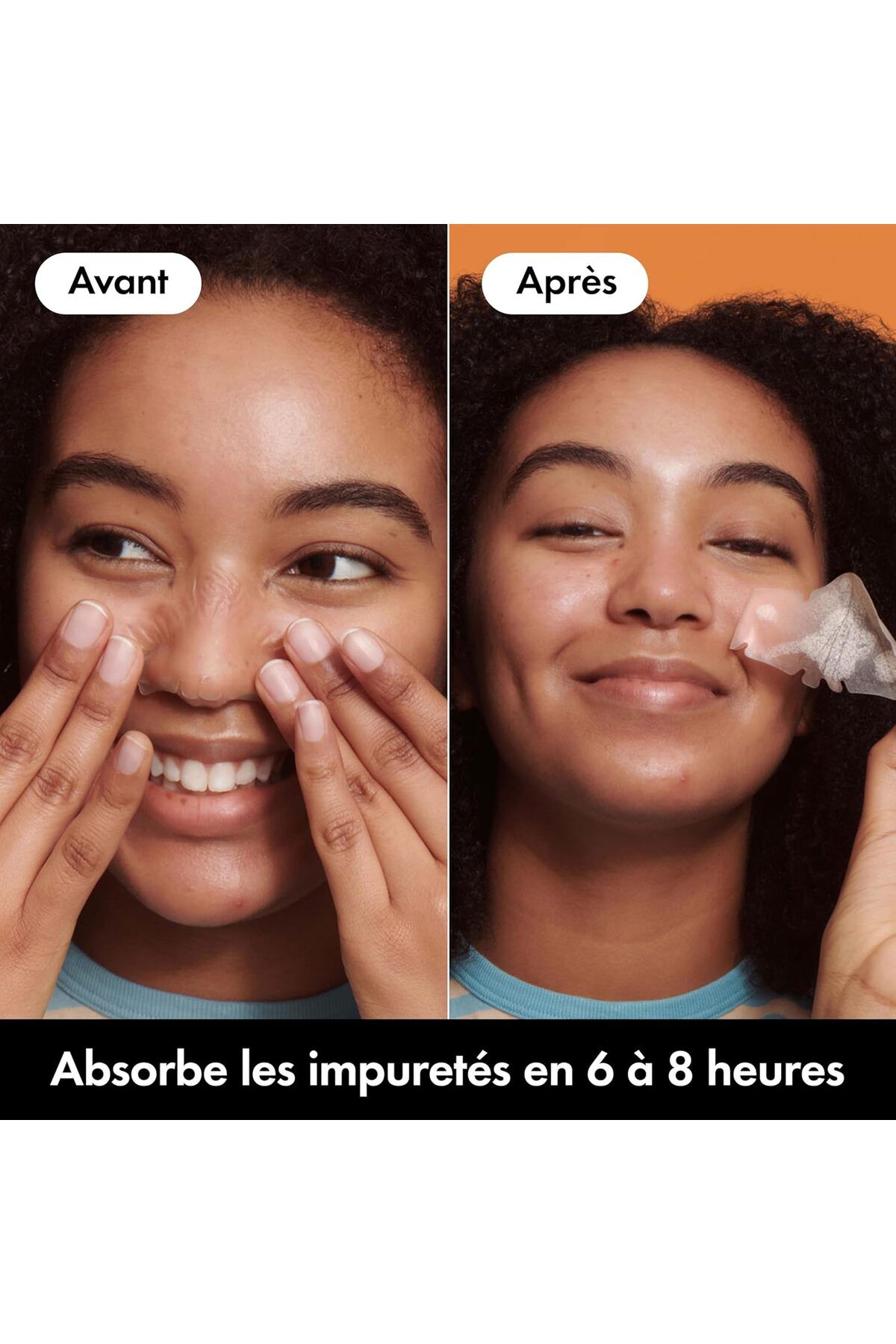 hero cosmetics-Hero - Mighty Patch Nose - Special Nose - Absorbs impurities from pores and pimples in 6 to 8 hours 7