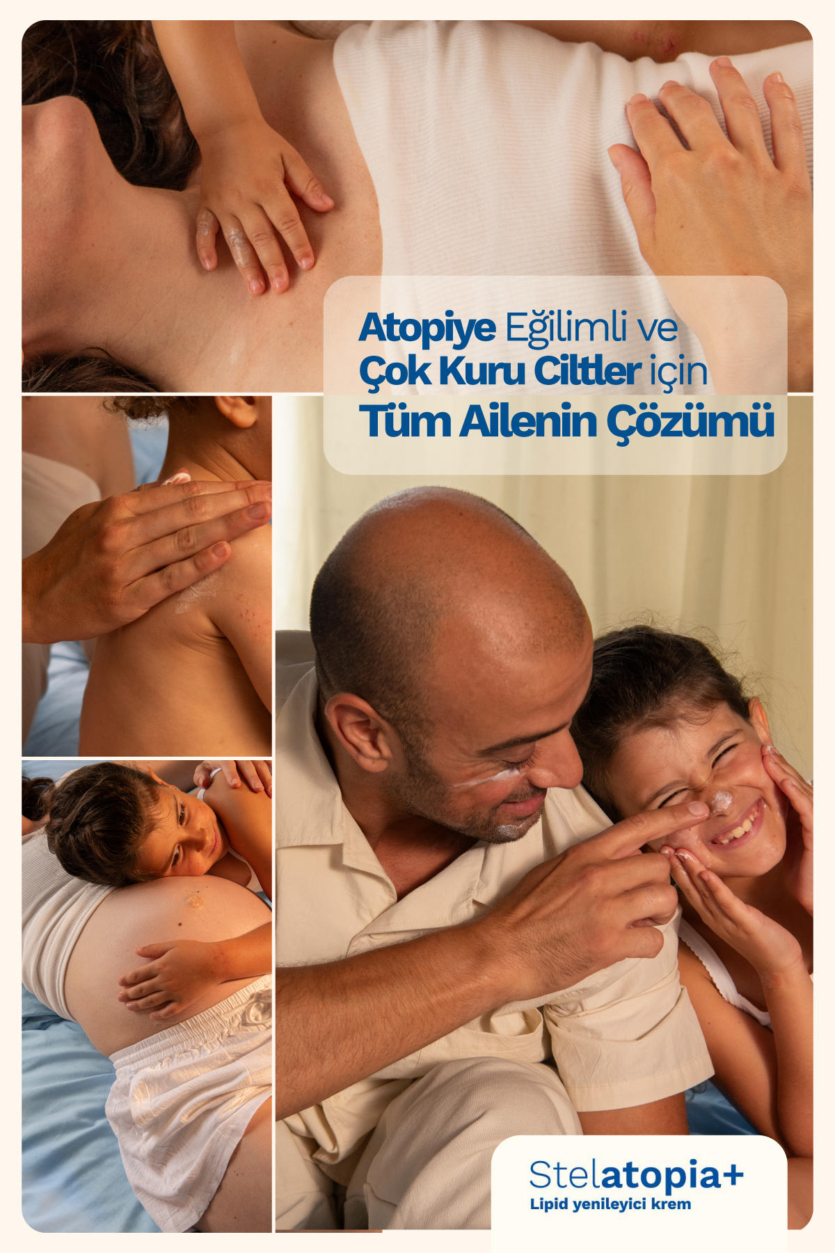 Stelatopia Lipit Yenileyici Atopik Cilt Ve Çok Kuru Cilt Için Rahatlatıcı Krem 300ml — SET.MST.45 — تصویر 2 از 8