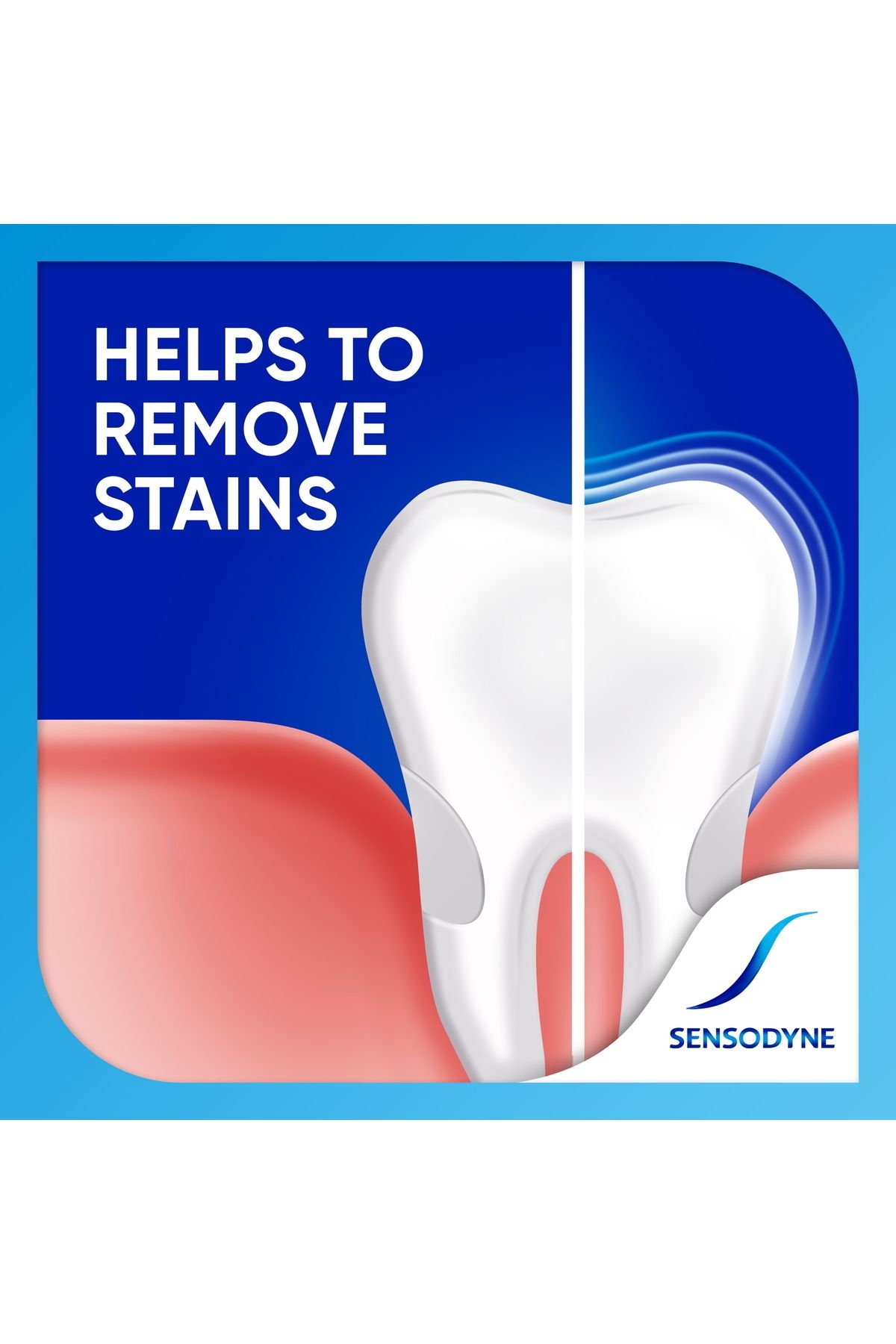 Sensodyne-معجون أسنان متعدد العناية بلس للتبييض 50 مل نترات البوتاسيوم (تخفيف الحساسية)، فلوريد الصوديوم 4
