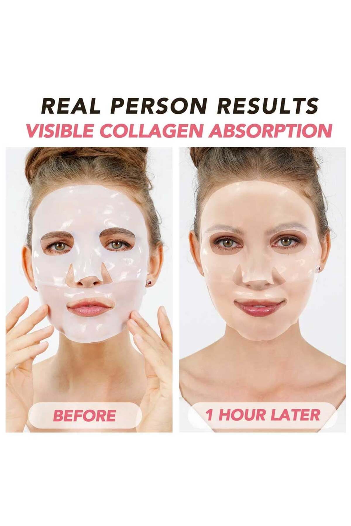 OEM-Set of 4 Masks with BIO Collagen, Advanced Formula with Probiotics, Hydro-Gel Technology 4
