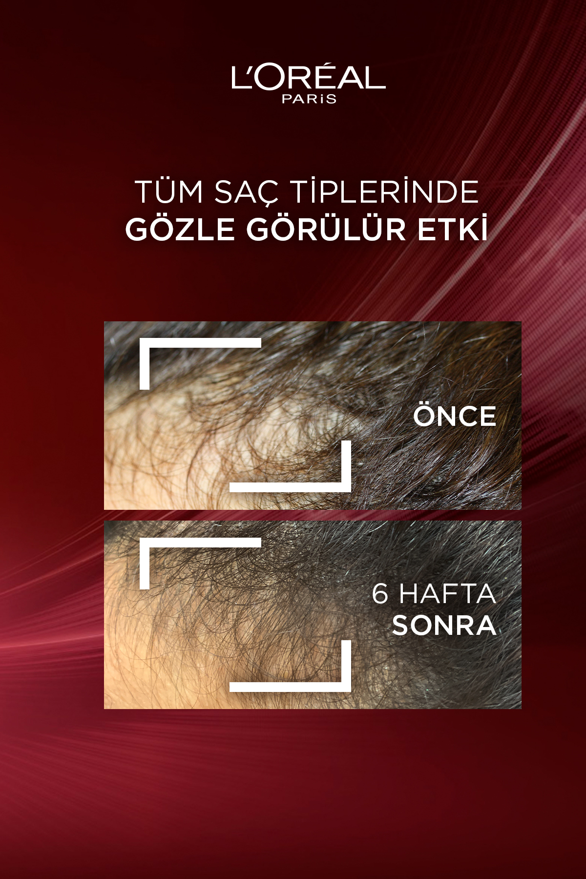 Komple Direnç Dökülme Karşıtı Şampuan 300 ml — 48552 — تصویر 3 از 8