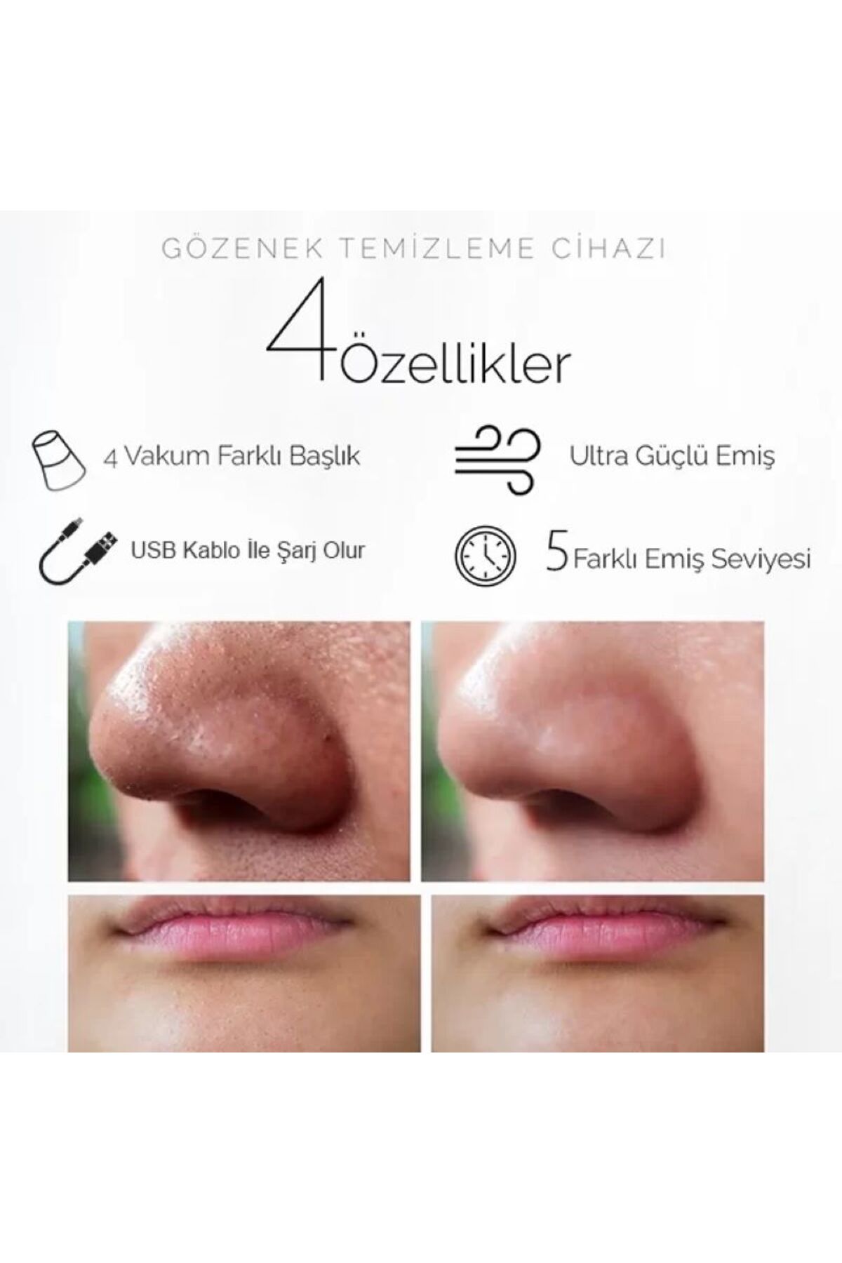 5 Kademeli Profesyonel Vakumlu Siyah Nokta ve Akne Temizleme Cihazı — P3030S4922 — تصویر 6 از 6